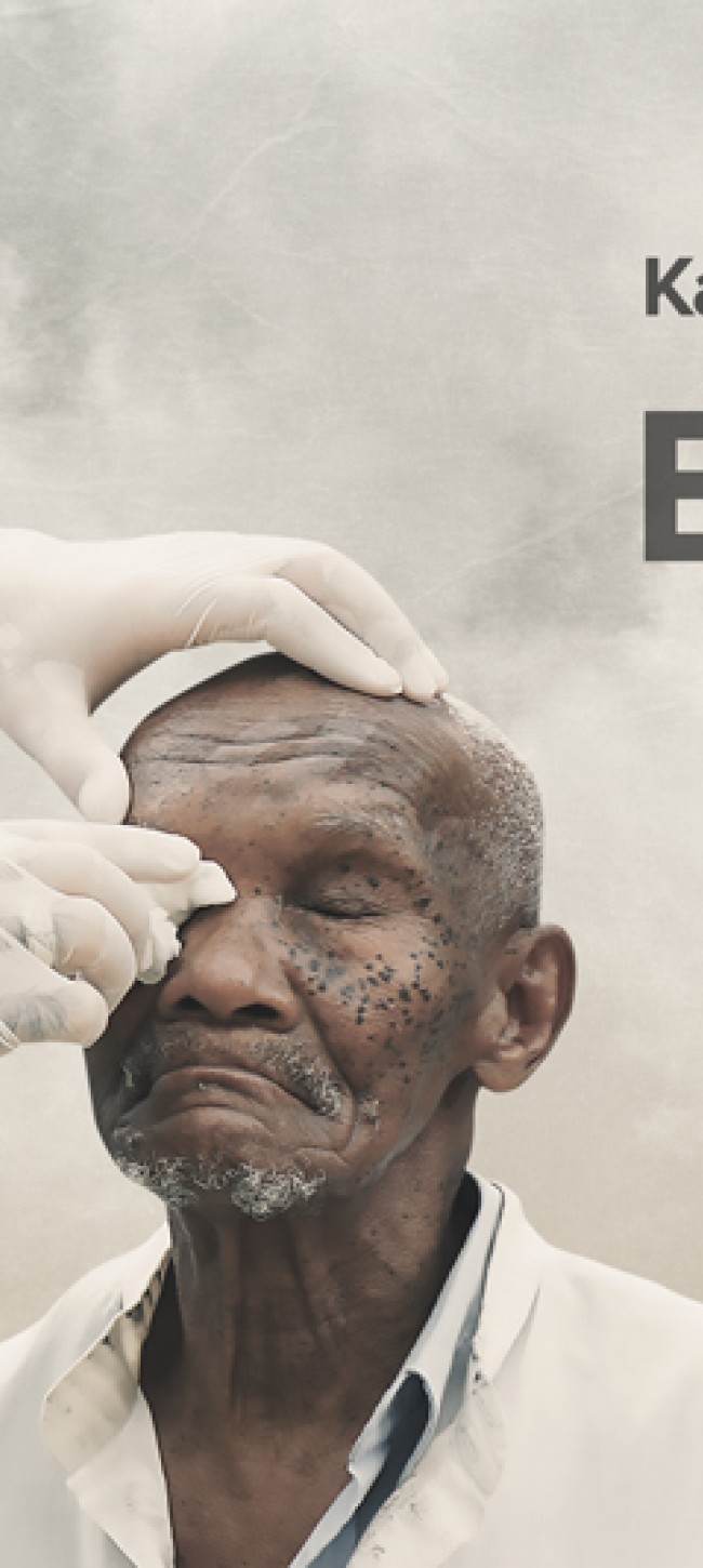 Cataract ( Eye surgery )